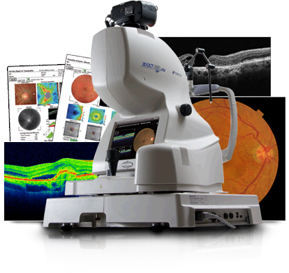High-resolution cross-sectional retinal imaging with Optical Coherence Tomography (OCT) for early glaucoma and AMD detection